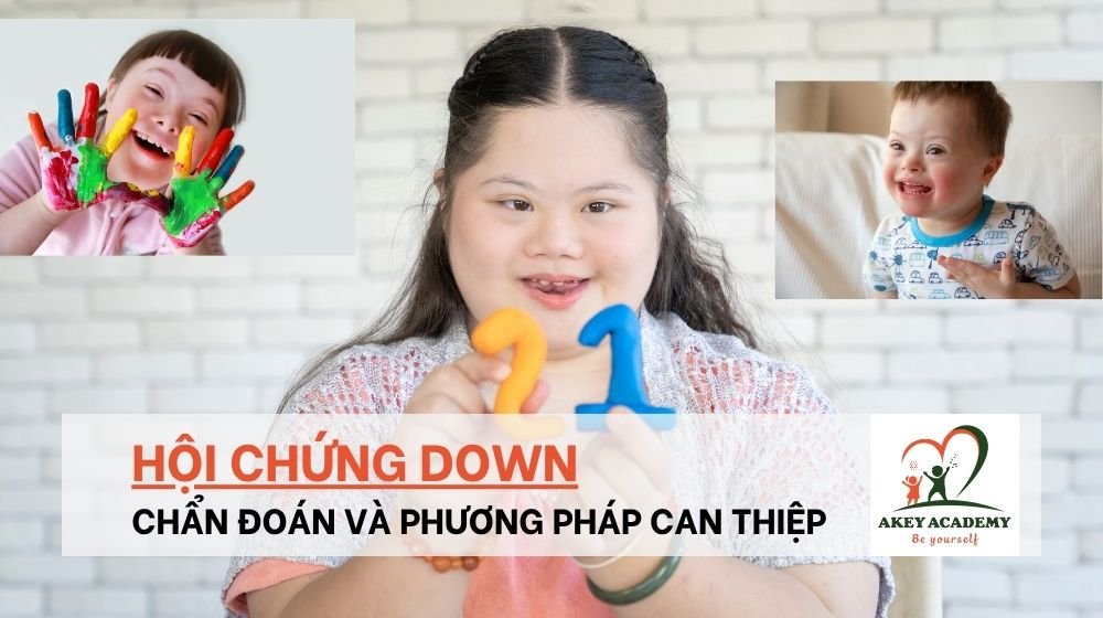 Hội chứng down